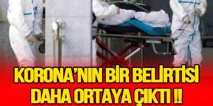 Bakanlık test kriterlerini değiştirdi..